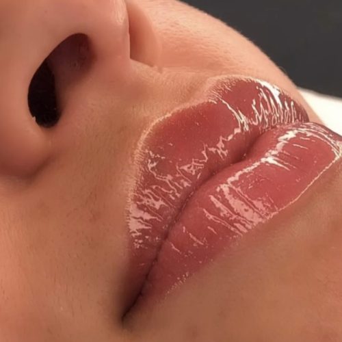 Lips-1200x900